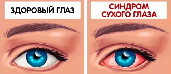 s6Y98V9W9CDSttf5.jpg s6Y98V9W9CDSttf5.jpg