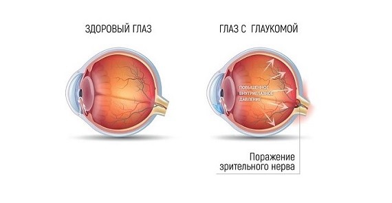 ylkhyxak5abhbpnnqewo4kdpt33k3bl7.jpg ylkhyxak5abhbpnnqewo4kdpt33k3bl7.jpg
